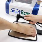 العلاج الطبيعي آلة العلاج Tecar الذكية لآلام العمود الفقري