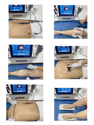 3 في 1 Tecar الإنفاذ الحراري EMS آلة بالمستخدمين للعلاج الطبيعي للجسم للإصابة الرياضية وتأثير السيلوليت